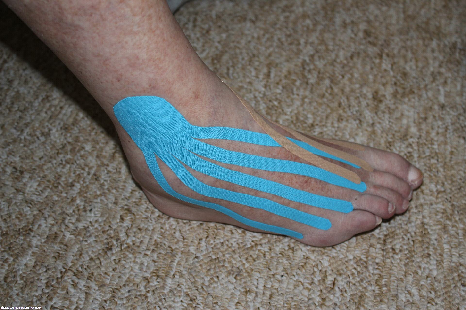 Kinesiologisches Tapen